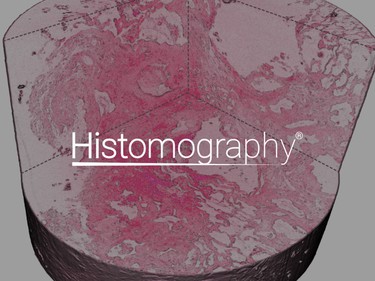 Histomography