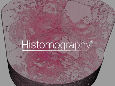 Histomography