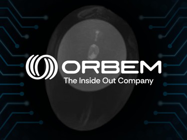 Orbem