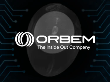 Orbem